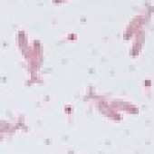Pink Ballet